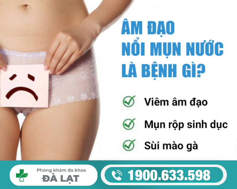 Hình ảnh minh họa